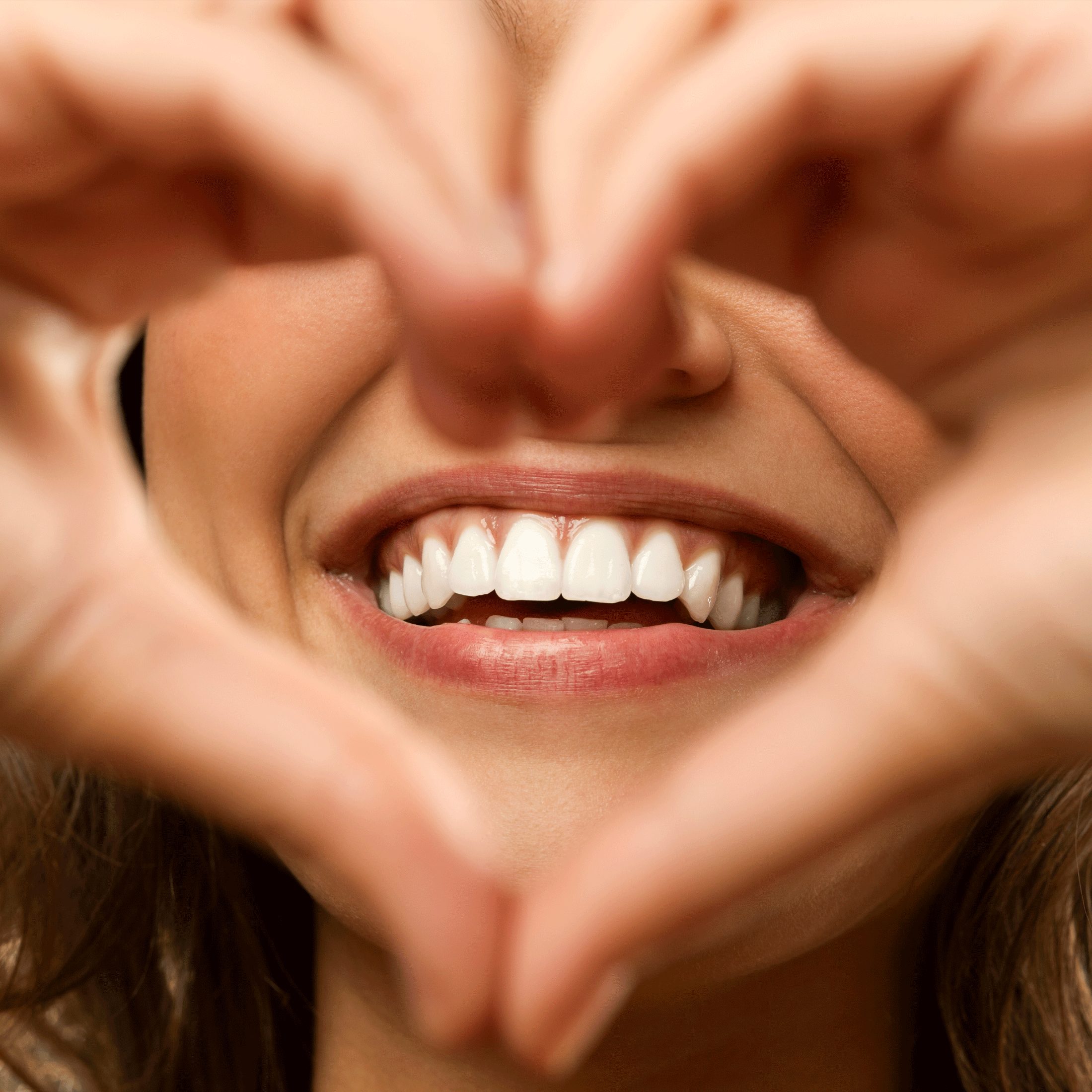 Odontologia estética: os benefícios do clareamento dental.