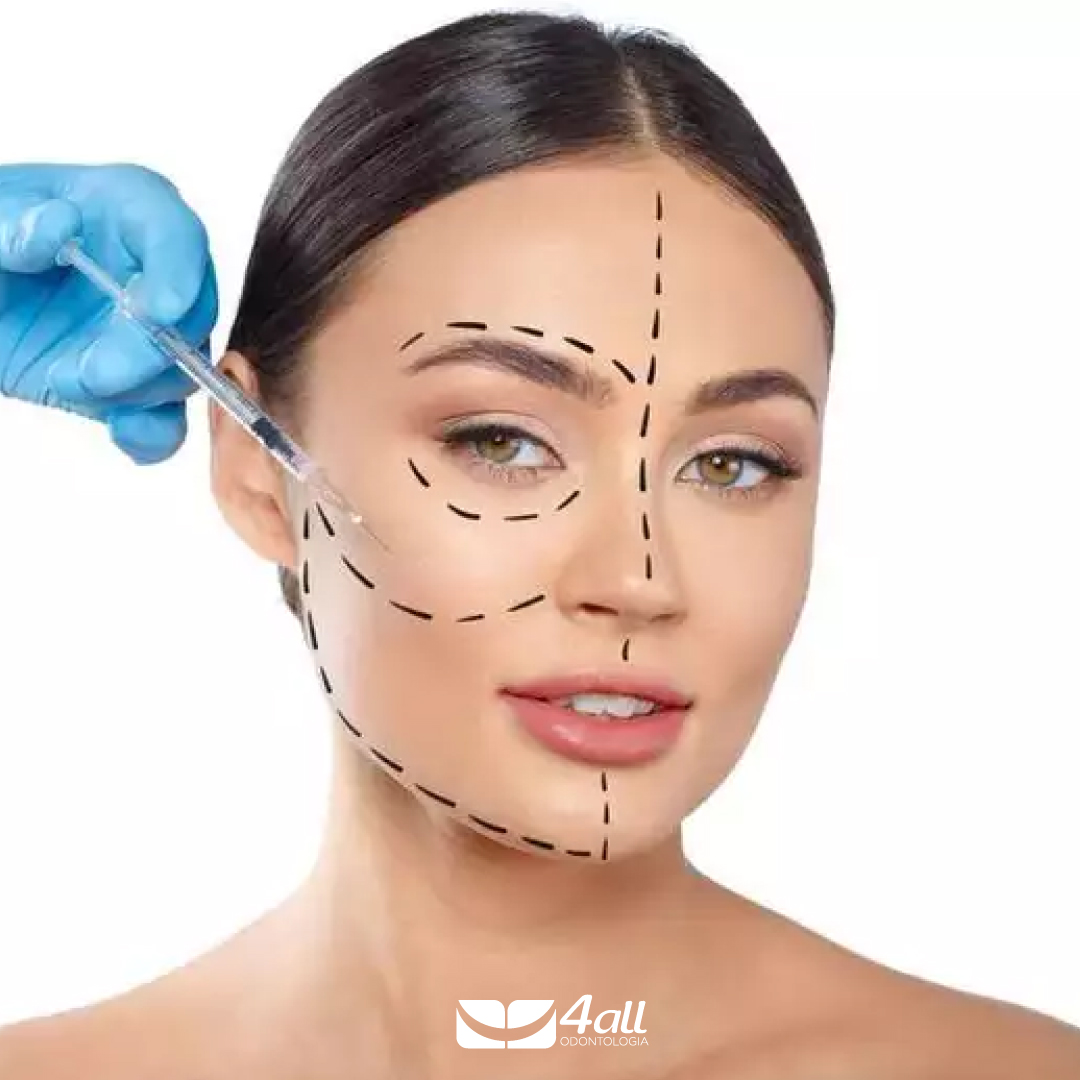 Tudo o que você precisa saber sobre a harmonização facial - Vila