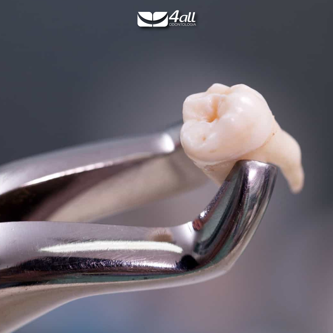 EXTRAÇÃO DE DENTES: O QUE VOCÊ PRECISA SABER