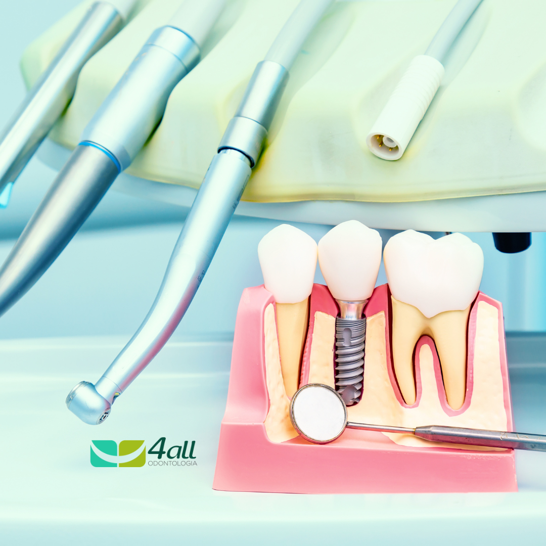 Implantodontia: Restaurando Sorrisos com Tecnologia Avançada