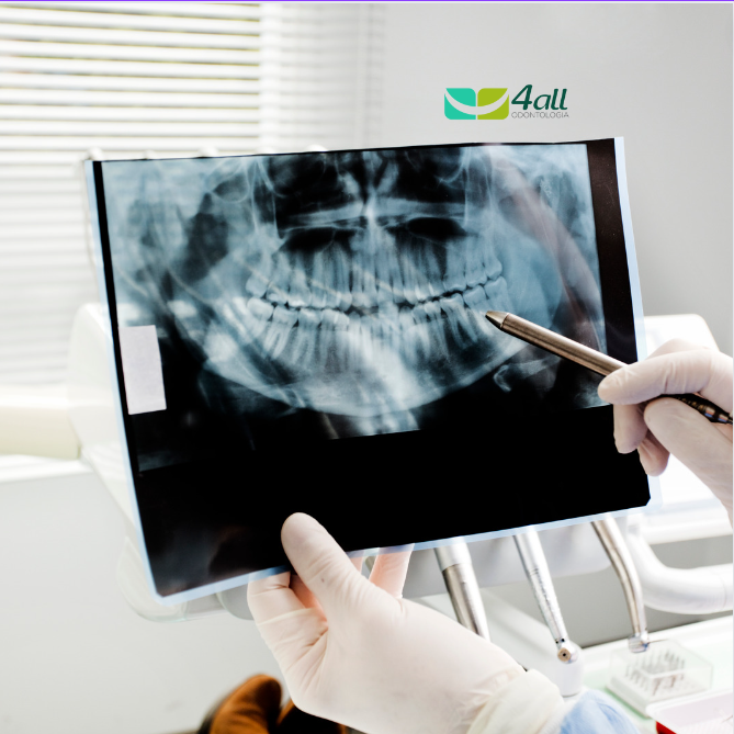 Cirurgia Bucal: Cuidando da Saúde Dentária com Precisão