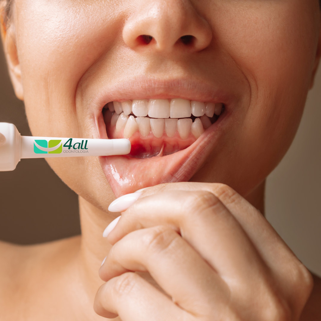 A Importância da Periodontia para a Saúde Bucal