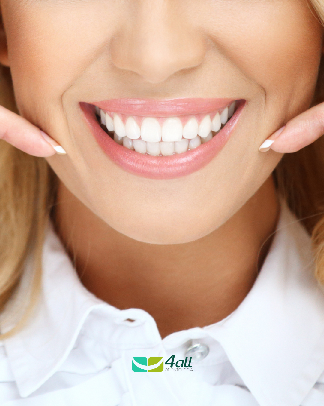 Extração do dente do siso: o que esperar