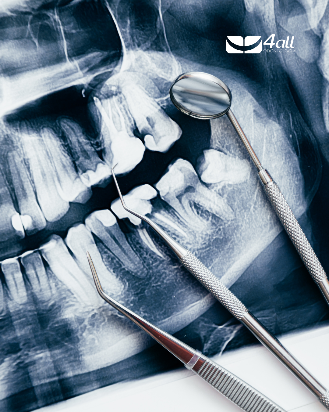 Cirurgias para corrigir fraturas e deformidades faciais
